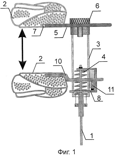Аппарат для механотерапии при дисфункциональных синдромах, артрозах и анкилозах височно-нижнечелюстных суставов (патент 2440063)