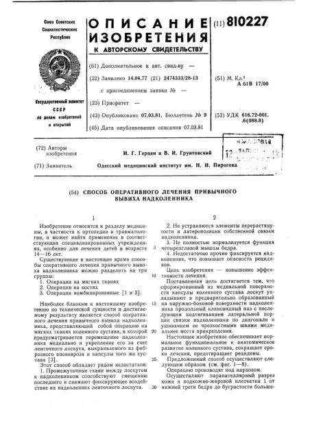 Способ оперативного лечения привыч-ного вывиха надколенника (патент 810227)