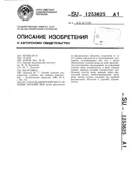 Способ хирургического лечения эктазий вен (патент 1253625)