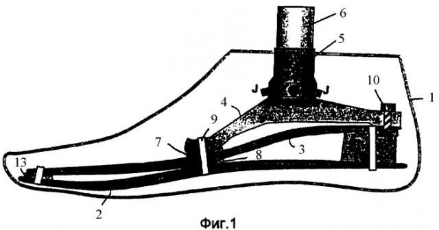 Ортопедически-техническое вспомогательное средство, в частности протез конечности (патент 2392905)
