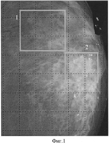 Способ диагностики заболеваний молочной железы на основании идентификации распределения эффективного атомного номера (патент 2391909)