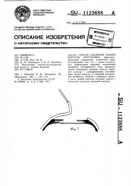 Способ удаления задней капсулы хрусталика (патент 1123688)