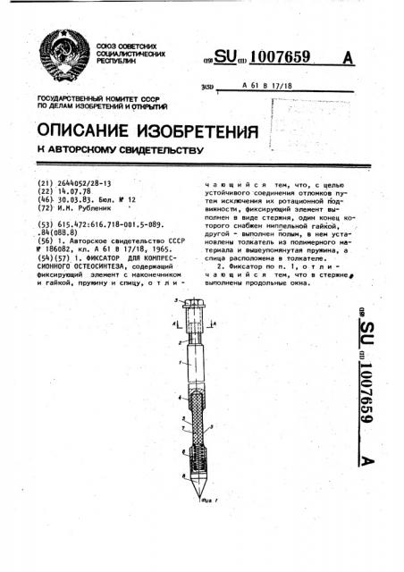 Фиксатор для компрессионного остеосинтеза (патент 1007659)