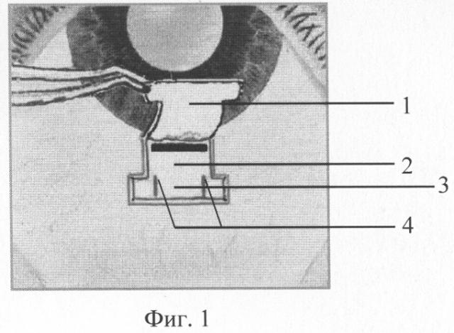 Способ хирургического лечения открытоугольной глаукомы (патент 2308917)