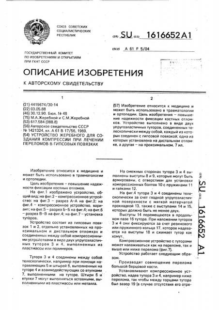 Устройство жеребного для создания компрессии при лечении переломов в гипсовых повязках (патент 1616652)