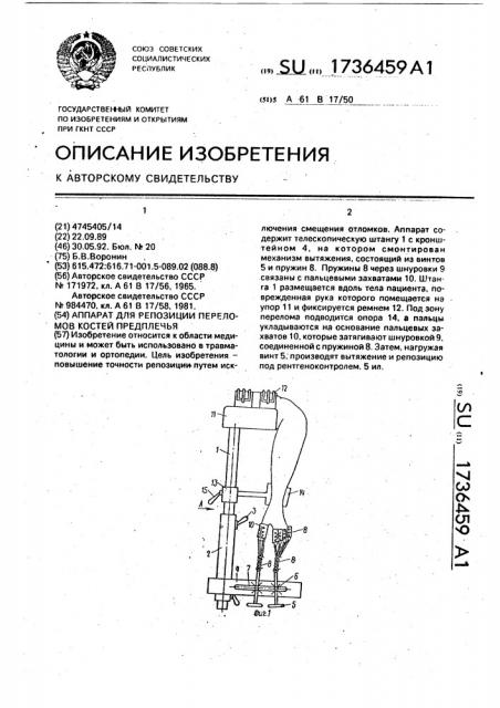 Аппарат для репозиции переломов костей предплечья (патент 1736459)