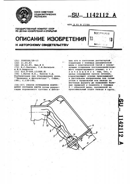 Способ устранения контрактур суставов кисти (патент 1142112)