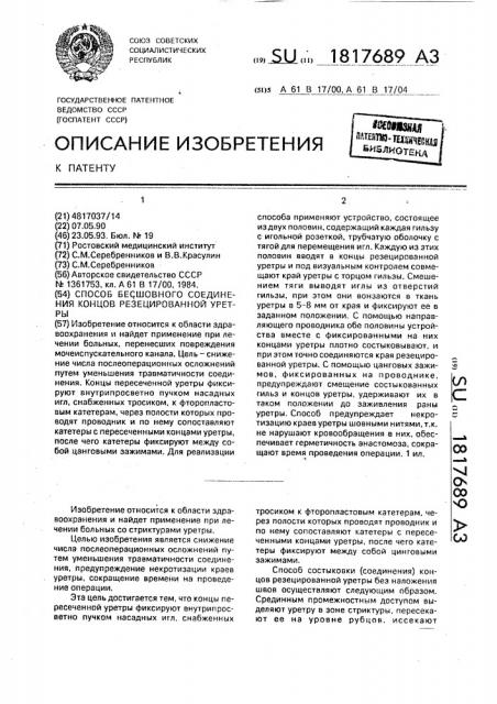 Способ бесшовного соединения концов резецированной уретры (патент 1817689)