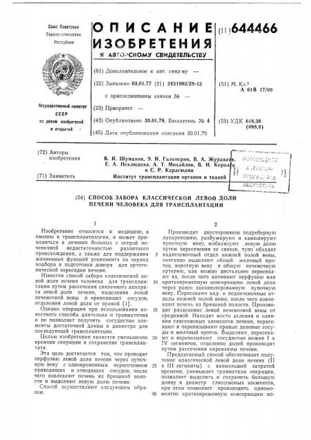 Способ забора классической левой доли печени человека для трансплантации (патент 644466)