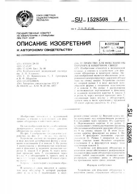 Устройство для фиксации обтуратора в кишечном свище (патент 1528508)