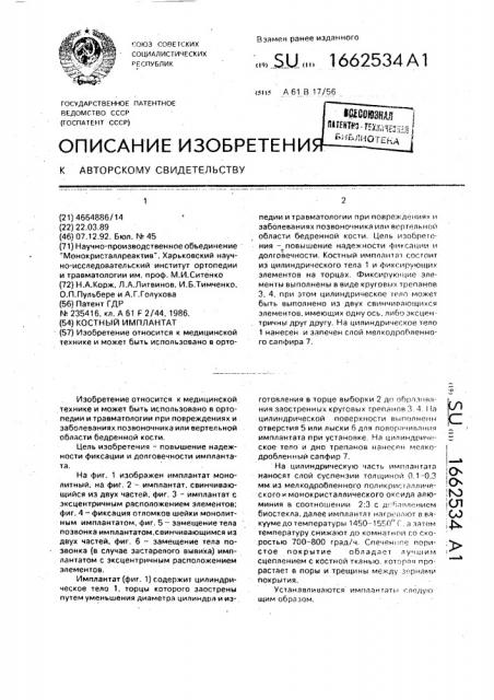 Костный имплантат (патент 1662534)