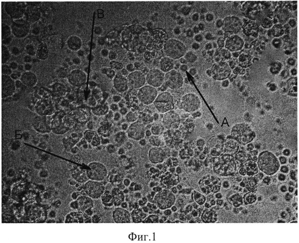 Штамм гибридных культивируемых клеток животных mus musculus α-продуцент моноклональных антител, специфичных к гранулоцитарному колониестимулирующему фактору (gcsf) человека (патент 2542381)