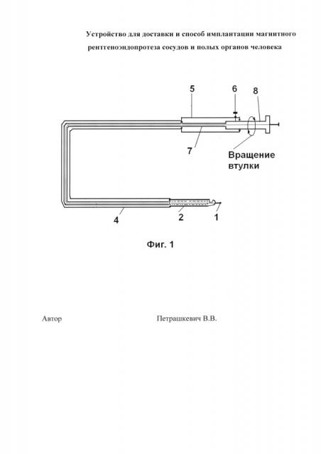 Устройство для доставки и способ имплантации магнитного рентгеноэндопротеза сосудов и полых органов человека (патент 2633469)