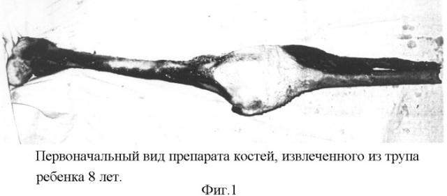 Способ обработки детских костей при изготовлении анатомических препаратов (патент 2320024)