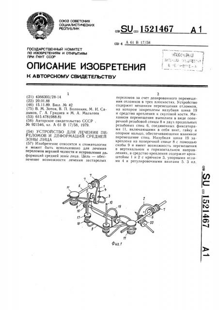 Устройство для лечения переломов и деформаций средней зоны лица (патент 1521467)