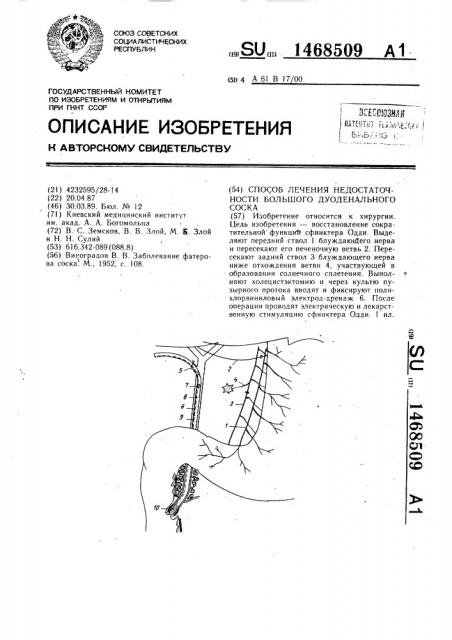 Способ лечения недостаточности большого дуоденального соска (патент 1468509)