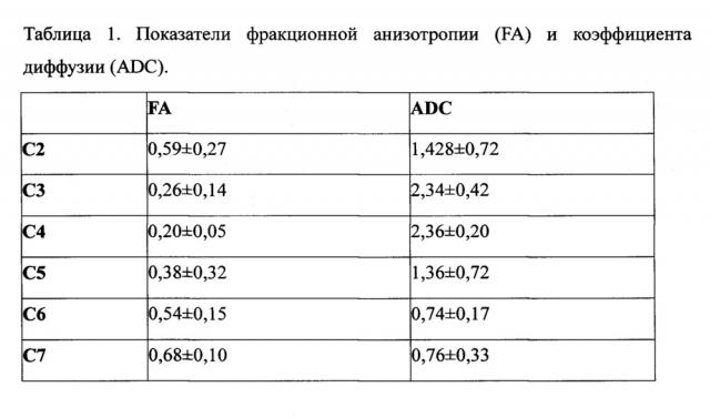 Способ диагностики спондилогенной шейной миелопатии без компрессии спинного мозга (патент 2657845)