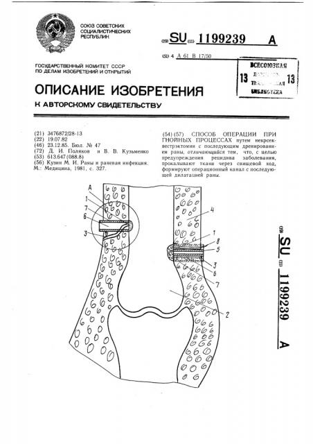 Способ операции при гнойных процессах (патент 1199239)