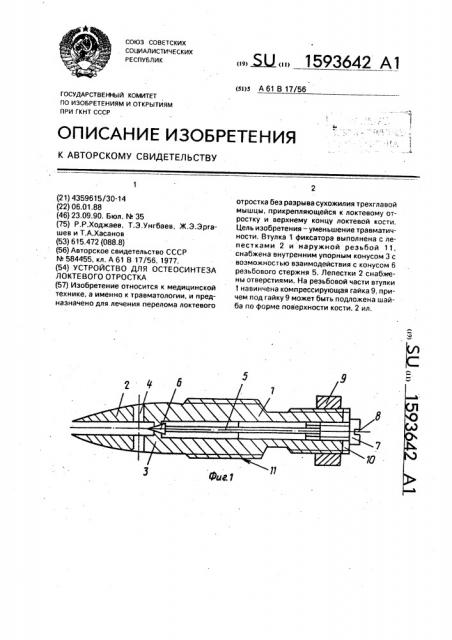 Устройство для остеосинтеза локтевого отростка (патент 1593642)