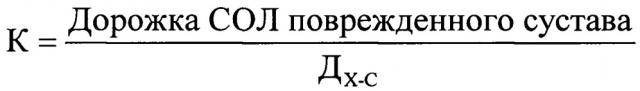 Способ оценки взаимодействия дефектов суставных поверхностей плечевого сустава при планировании хирургического лечения передней нестабильности (патент 2661717)