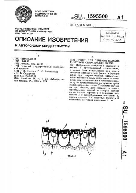 Протез для лечения патологической стираемости зубов (патент 1595500)