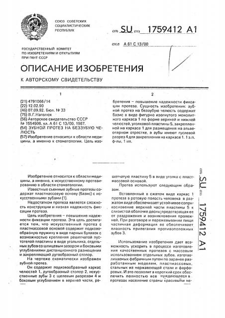 Зубной протез на беззубную челюсть (патент 1759412)