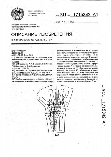 Эндопротез лучезапястного сустава (патент 1715342)