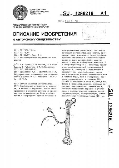 Способ лечения остеомиелита (патент 1286216)