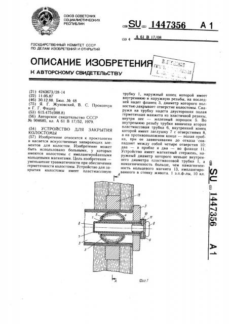 Устройство для закрытия колостомы (патент 1447356)