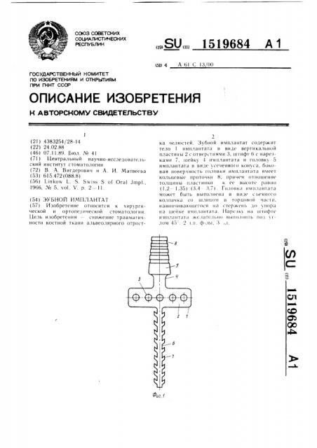 Зубной имплантат (патент 1519684)