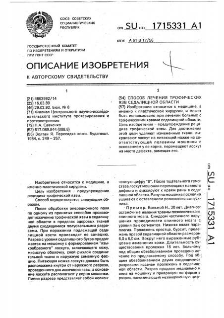 Способ лечения трофических язв седалищной области (патент 1715331)