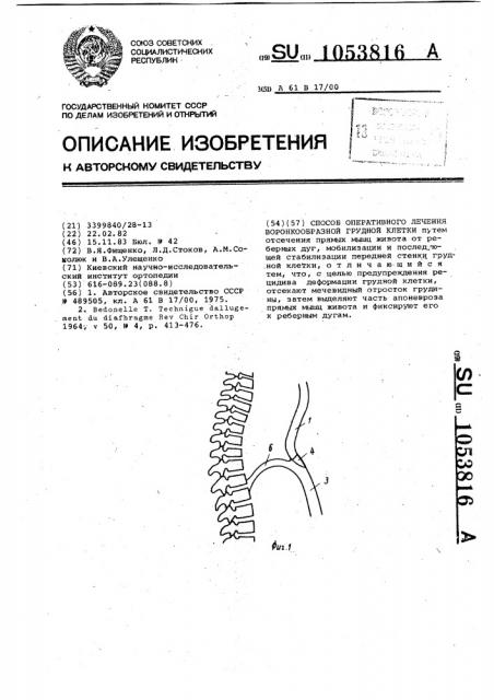 Способ оперативного лечения воронкообразной грудной клетки (патент 1053816)