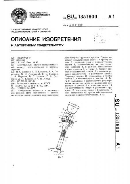 Протез бедра (патент 1351600)