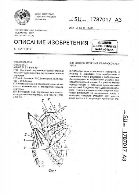 Способ лечения рефлюкс-гастрита (патент 1787017)