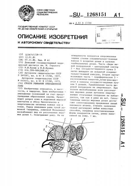 Способ ушивания операционной раны (патент 1268151)