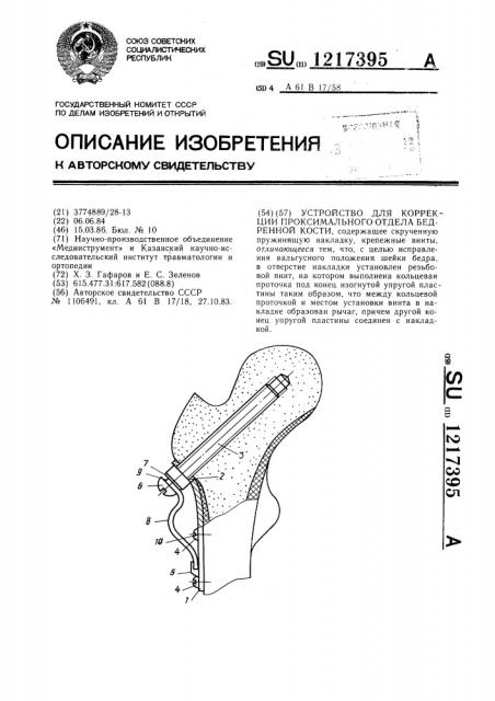 Устройство для коррекции проксимального отдела бедренной кости (патент 1217395)