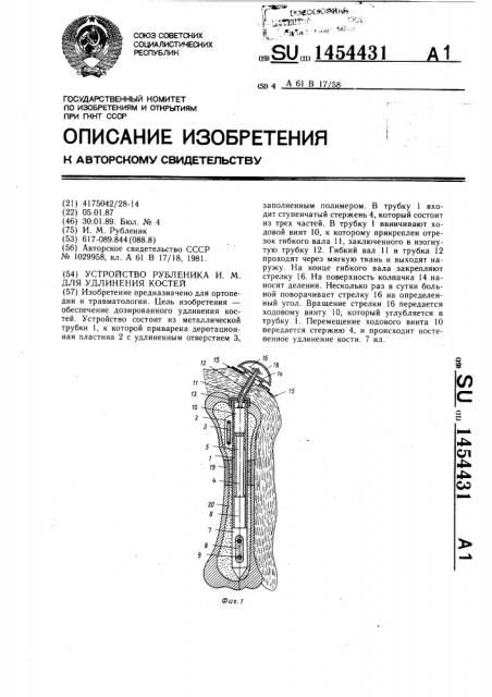 Устройство рубленика и.м. для удлинения костей (патент 1454431)