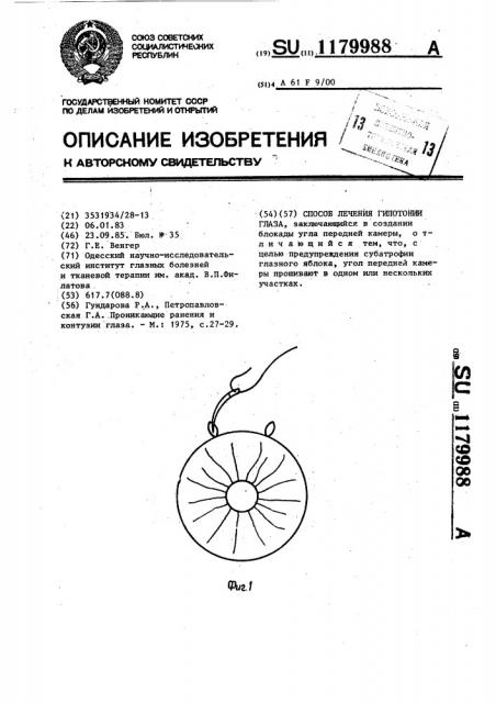 Способ лечения гипотонии глаза (патент 1179988)