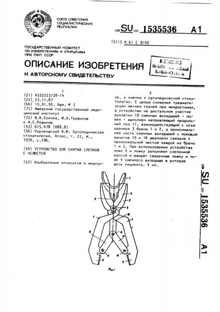 Устройство для снятия слепков с челюстей (патент 1535536)