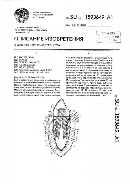 Искусственный зуб (патент 1593649)