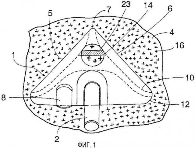 Всасывающее устройство пылесоса (патент 2331353)