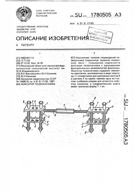 Фиксатор позвоночника (патент 1780505)