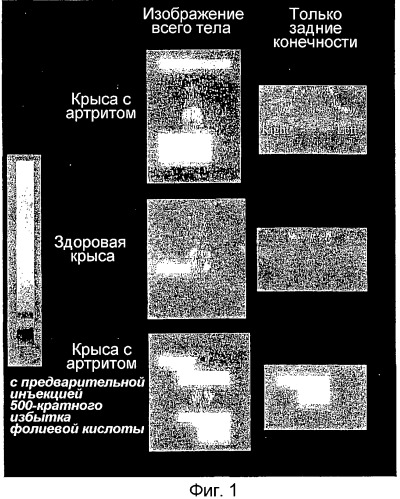 Лечение и диагностика заболеваний, опосредованных макрофагами (патент 2316349)