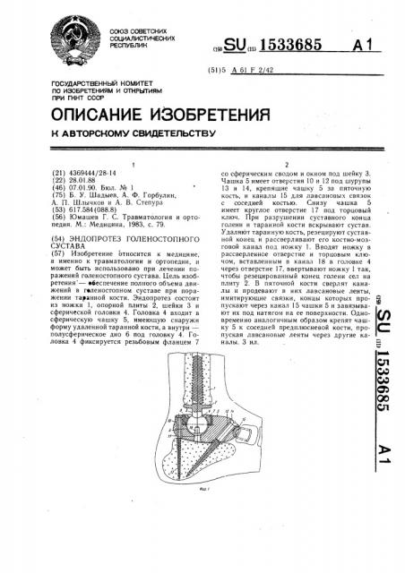 Эндопротез голеностопного сустава (патент 1533685)