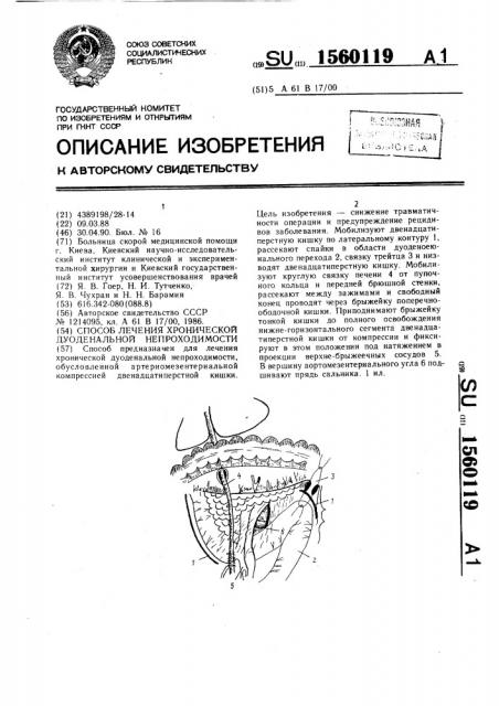 Способ лечения хронической дуоденальной непроходимости (патент 1560119)