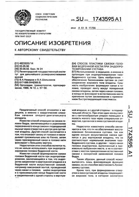 Способ пластики связки головки бедренной кости при эндопротезировании сустава (патент 1743595)