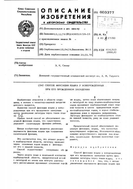 Способ фиксации языка у новорожденных при его врожденном западении (патент 603377)