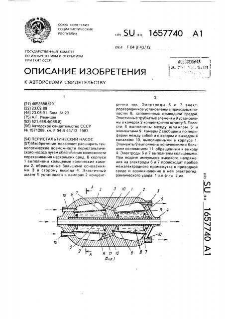 Перистальтический насос (патент 1657740)