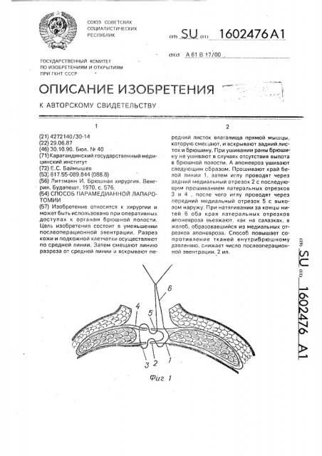 Способ парамедианной лапаротомии (патент 1602476)