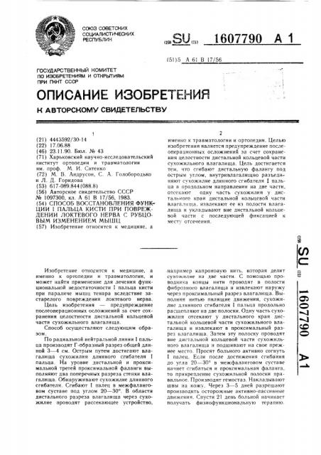 Способ восстановления функции i пальца кисти при повреждении локтевого нерва с рубцовым изменением мышц (патент 1607790)